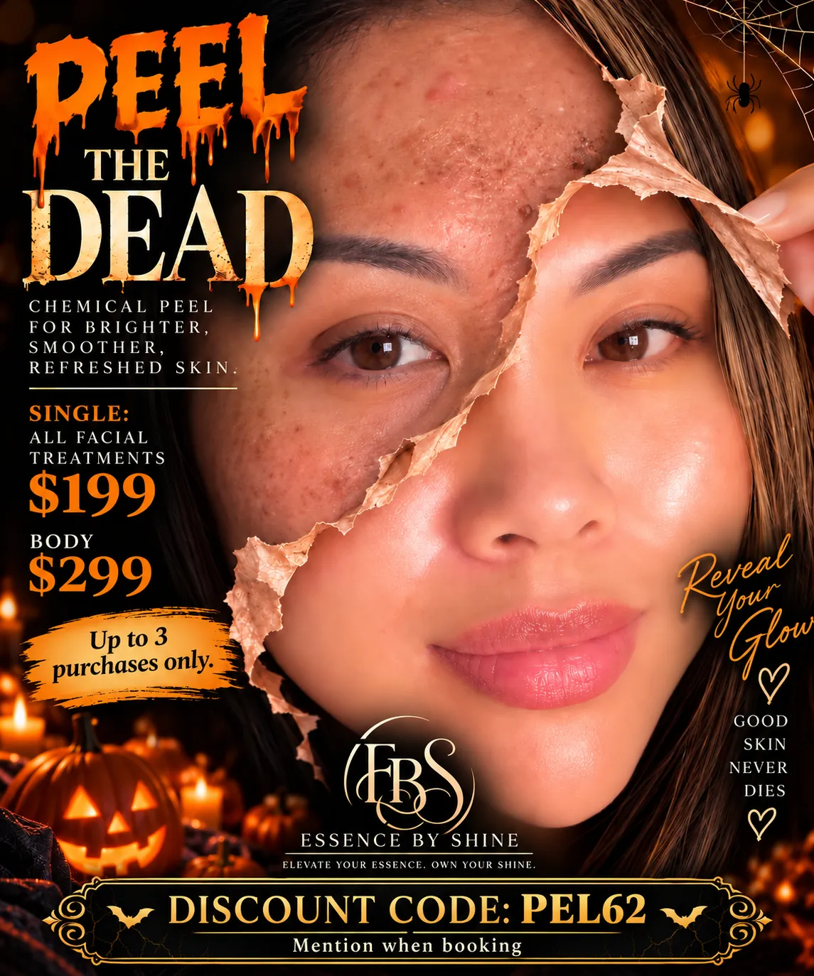 Peel the Dead Halloween promotion — chemical peel, $199 for facial treatments and $299 for body, up to 3 purchases only.